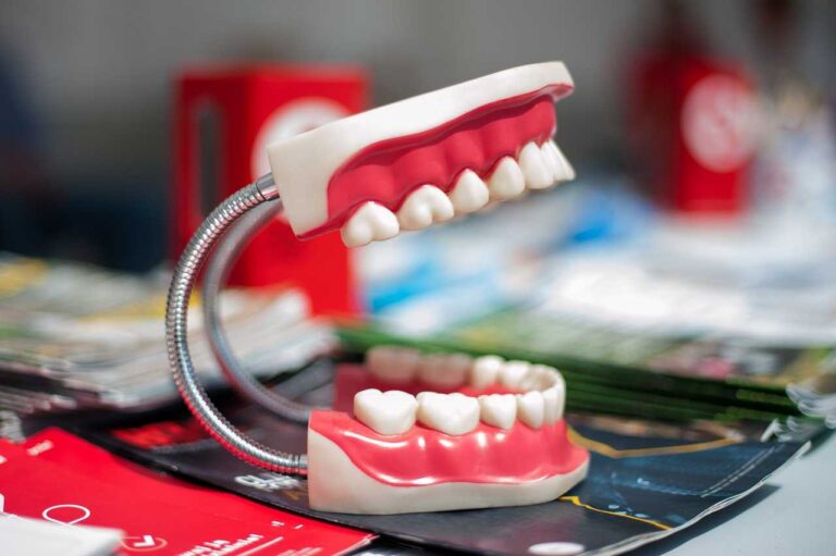 Model of a tooth alongside a red tongue, illustrating dental crowns and bridges in a dental education context.