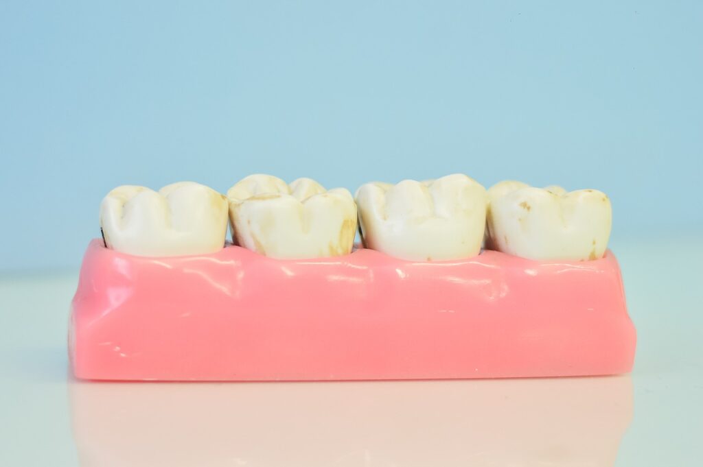 A tooth model displayed on a pink surface, highlighting the importance of restorative care in dental health.